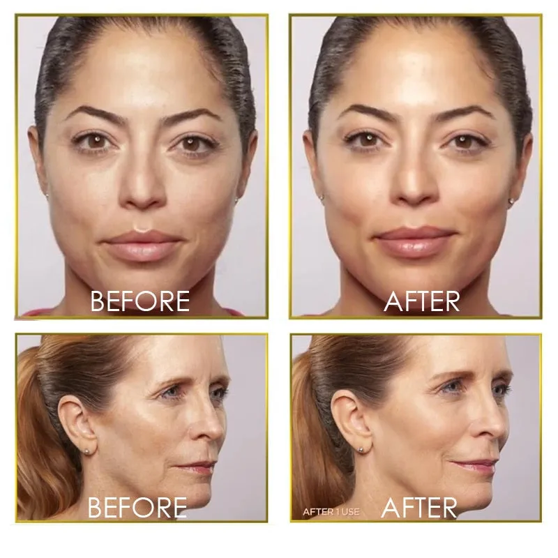 Flawless Dermaplane Glo Hair Remover Women
